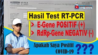 Cara Membaca Hasil Tes RTPCR Corona PCR real Times  RdRp gene Positif N gene Positif [upl. by Konstance]