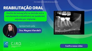 Decisão entre um retratamento endodôntico e exodontia com implantes [upl. by Jillayne]