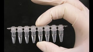 PCR optimization  PCR technique [upl. by Henden]