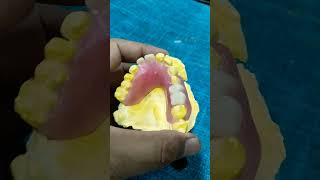 Upper Flexible Partial Denture By Haider 😁😁😁flexible partialdenture [upl. by Awram]