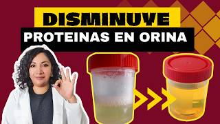 ELIMINA LA PROTEINURIA proteinas en la orina con estos CONSEJOS 👩🏻‍⚕️ [upl. by Serena]