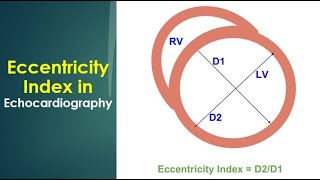 Eccentricity Index in Echocardiography [upl. by Ecnarrot33]