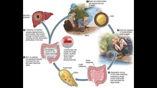 Protozoal Infections  Examples Types Symptoms Diagnosis Treatment Prevention [upl. by Nayr]