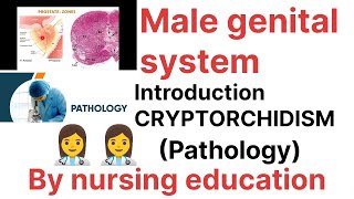 PathologyMale genital system Introductioncryptorchidism Bsc nursing [upl. by Ecnedac]