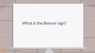 What is the Beevor sign [upl. by Notlimah800]