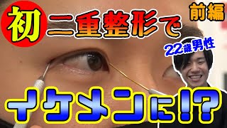 【イケメン変身企画】前髪でなるべく隠していた一重。二重整形ではたして男性はイケメンになれたのか？埋没二重二重にする方法【湘南美容クリニック】 [upl. by Akinnej]