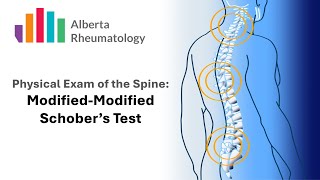 Rheumatology BACK exam Schobers Test [upl. by Holmen451]