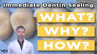 Immediate Dentin Sealing  Biomimetic Dentistry  What Why and How to Perform [upl. by Malissia]