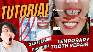 Tutorial How to use Moldable False teeth [upl. by Sussman]