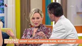 Sedef hastalığından nasıl kurtulunur  Eczacı Reyhan Aliusta [upl. by Maynard]