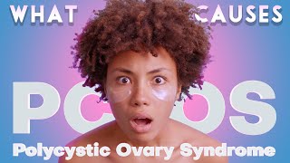 Why PCOS is More Than Just Ovaries [upl. by Melar651]