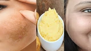 pigmentation home remedy get clear Spotless skin with this remedy kaurtips [upl. by Ilatfen]