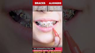 Braces vs Aligners  What is better for you ytshorts braces aligners invisalign cost india [upl. by Bethena936]