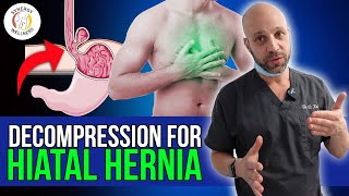 Pull Stomach Down From Diaphragm using Decompression for Hiatal Hernia [upl. by Marlea]