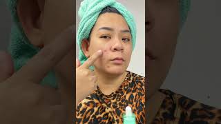 For Acne Prone and Sensitive Skin  AXIS  Y blemish spot Treatment [upl. by Kenji]