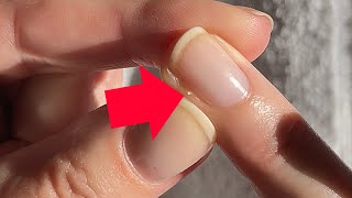 How to remove a hangnail like a PRO Pro Nail Technician Explains [upl. by Jecon]