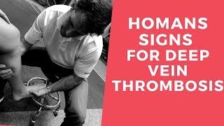 Homans Sign for Deep Vein Thrombosis [upl. by Warwick]