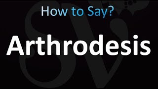 How to Pronounce Arthrodesis Correctly [upl. by Roselle35]