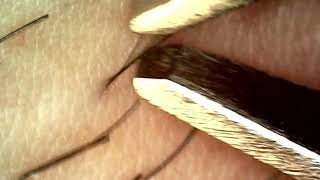 Achieve Perfectly Smooth Skin with Tweezers – No Hair Left Behind [upl. by Monteria]