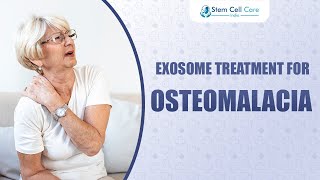 Exosome Treatment For Osteomalacia  Osteomalacia Treatment  Stem Cells  Orthopedic Disease [upl. by Lemar]