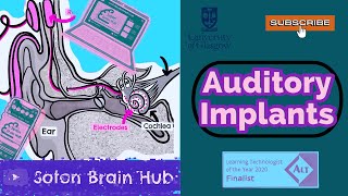 Cochlear Implants [upl. by Holland]