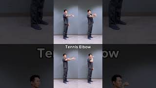 Tennis elbow [upl. by Lledroc477]