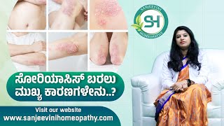 Psoriasis Types Symptoms Causes Pathology and Treatment Best Psoriasis Treatment [upl. by Solis]