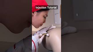 Injection Tutorial tutorial injection shorts littos [upl. by Yduj]