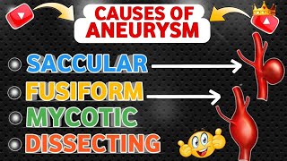 Understanding  Causes Of Aneurysm 😍 [upl. by Learrsi329]