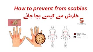 HOW TO PREVENT SCABIES خارش سے کیسے بچا جائے EASY TO UNDERSTAND [upl. by Diba]