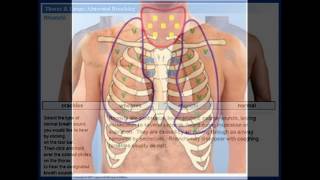 normal tracheal sound [upl. by Grindle]