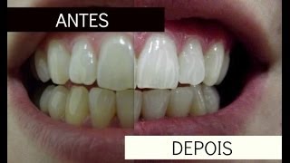 Clareamento dental com produto Oral B [upl. by Eytak766]