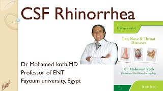 CSF rhinorrhea Professor Dr Qotb [upl. by Clemence]