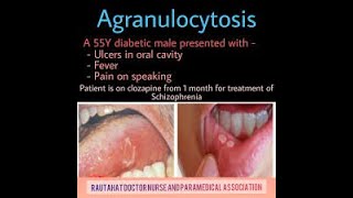 Agranulocytosis Symptoms and Causes  Diagnosis  Treatment  Prevention [upl. by Mufi]