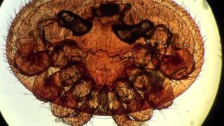 Varroa destructor Under Microscope X400 Dangerous Parasite of Honeybees in ENGLISH [upl. by Oisinoid]