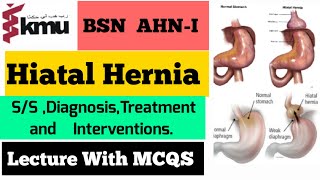 Hiatal Hernia In UrduHindi  Hiatal Hernia Diagnosis Treatment and Interventions  BSN Farman [upl. by Marven]