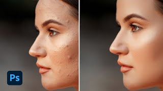 HighEnd skin retouch in 1 minute on photoshop  Photoshop tutorial [upl. by Diarmuid]