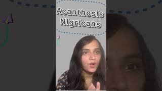 Do you have dark neck acanthosisnigricans insulinresistance [upl. by Nies659]