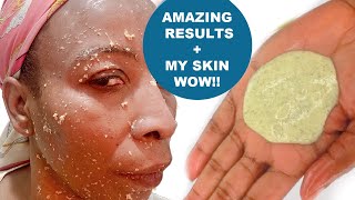 How To Exfoliate Your Face At Home Naturally [upl. by Rivalee279]