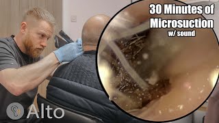 30 Minutes of MICROSUCTION Ear Wax Removal [upl. by Eelydnarb183]