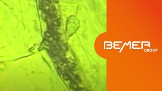 The BEMER Effect  microscopic demonstration of the effect on microcirculation  EN [upl. by Anelah]