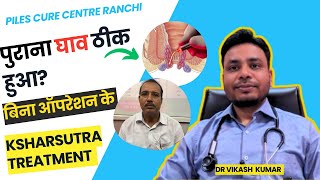 Recurrence Fistula treatment in ranchi Jharkhand without surgery drvikashkumar 9162732562 [upl. by Issi]