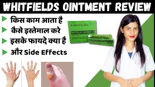 Whitfields Ointment IP in Hindi  Uses  Review  Cracked Skin  Side Effects  Price [upl. by Eelinnej450]