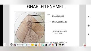 gnarled enamel dental histology histology lecture [upl. by Demha316]