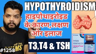 थायरॉइड बढ़ने का कारण ओर इलाज  Hypothyroidism Causes Symptoms amp Treatment In Hindi [upl. by Notseh541]