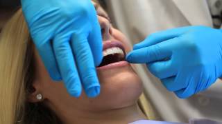 Instructions for Using a Teeth Whitening Strip  Dental Health [upl. by Nevlin]