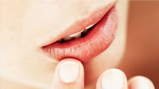 The Basics Canker Sore Causes and Treatments [upl. by Halilahk]