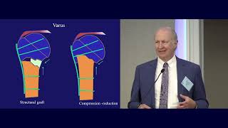 06 Proximal Humerus Fractures Michael Mckee MD [upl. by Eadas]