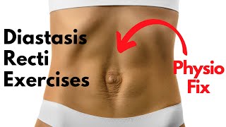 How to START Diastasis Recti Exercises that FIX YOUR GAP  PHYSIO GUIDED Abdo Separation Repair [upl. by Kristyn]