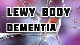 Latest Facts of Lewy Body Dementia Symptoms and Treatments Explained easy to understand [upl. by Heywood239]